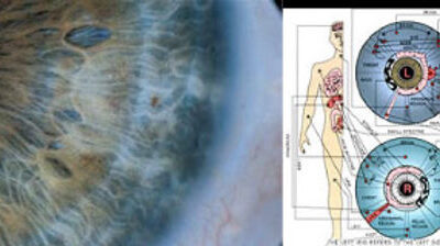L’iridologie